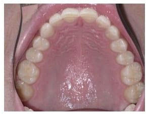 Solomons MD Cosmetic Dentist