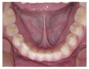 Dentist in Solomons MD