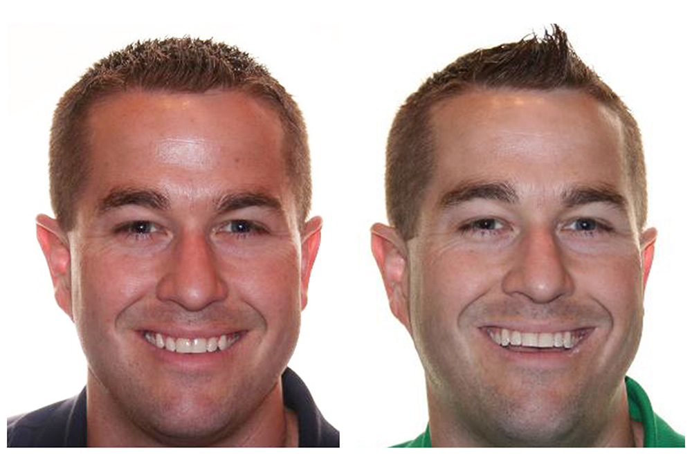 Friendly Smiles of Solomons