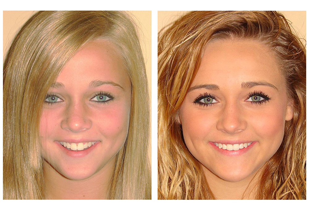 Friendly Smiles of Solomons