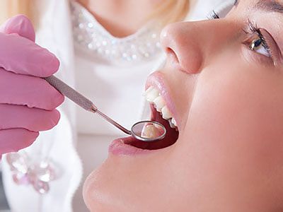 Dentist in Solomons MD